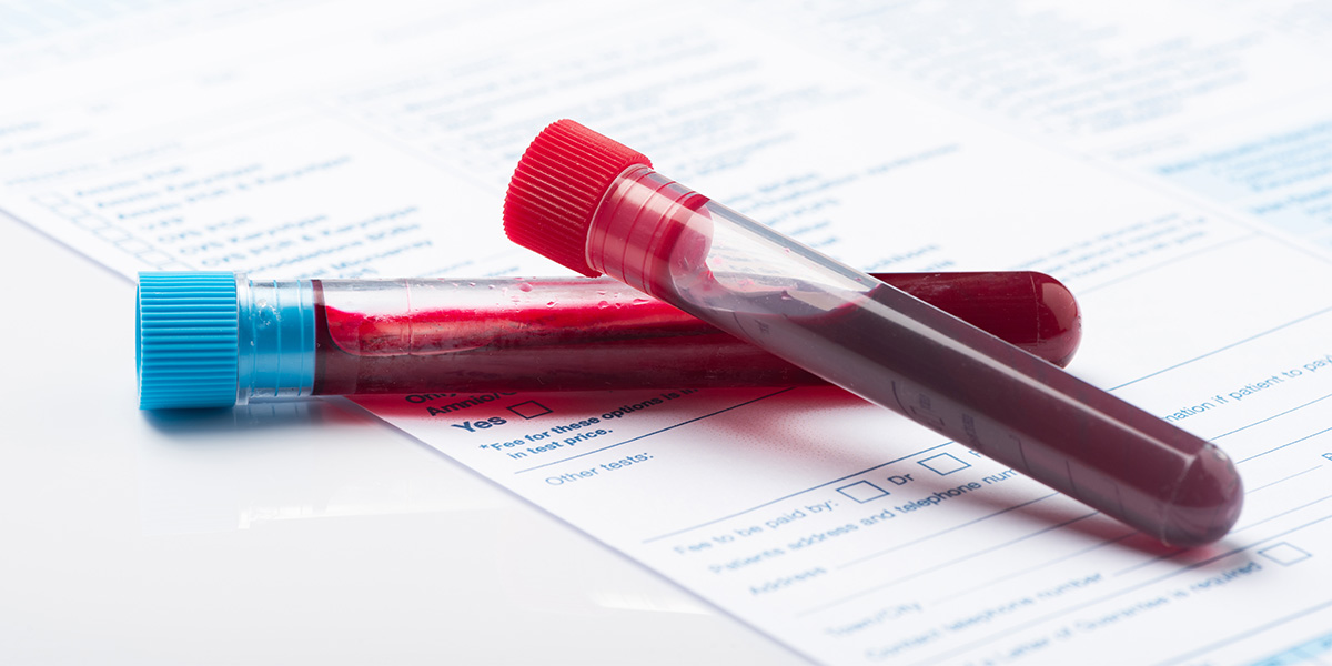 Muestras de sangre en el examen médico migratorio: para qué se toman y cómo se procesan